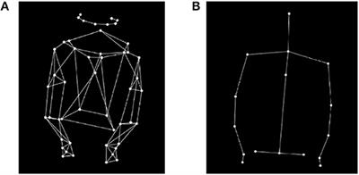 Kinematic Analysis of Pianists' Expressive Performances of Romantic Excerpts: Applications for Enhanced Pedagogical Approaches